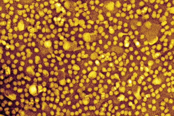 Gene-Editing Drug Shows Promise in Lowering LDL Cholesterol