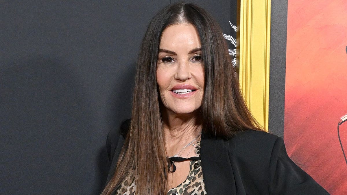 Janice Dickinson’s Dramatic Transformation After Facial Rejuvenation