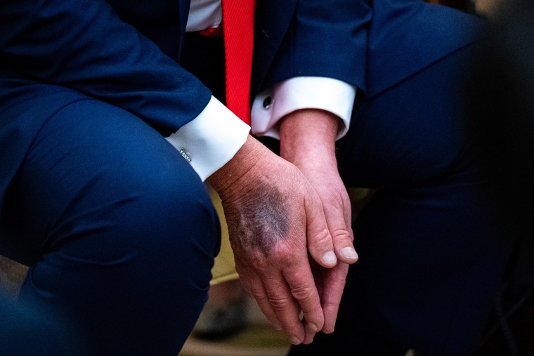 President Trump to Undergo Medical Check-Up at Walter Reed