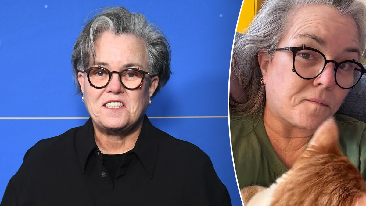 Rosie O’Donnell’s Reflections on Choosing Cosmetic Surgery
