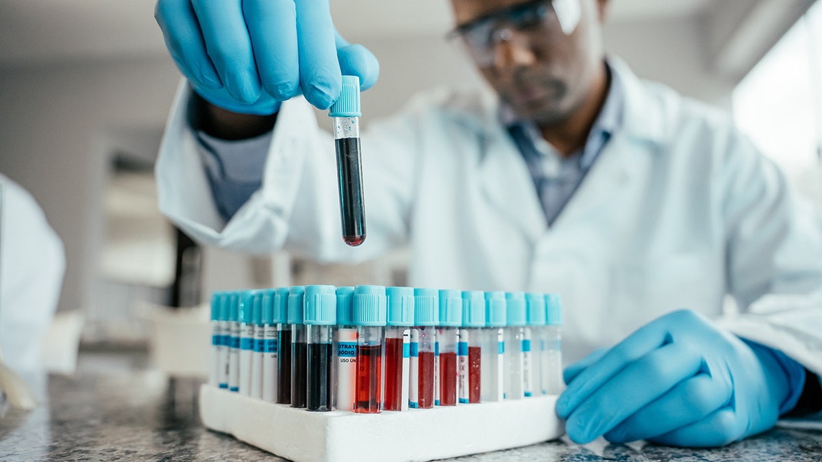 Research Shows Link Between Biological Age and Dementia Risk