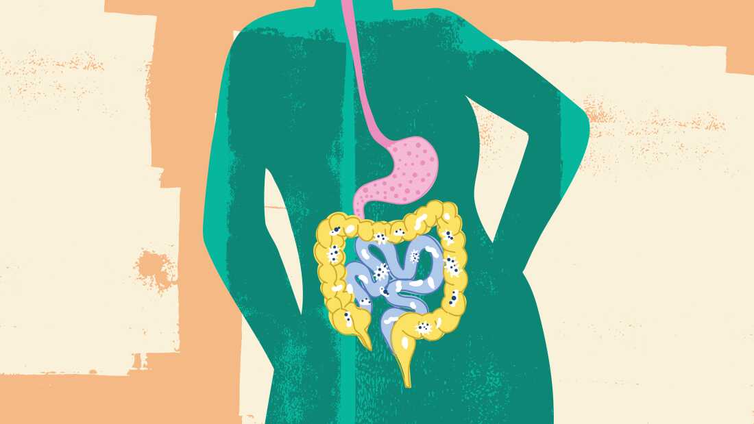 Understanding the Gut Microbiome: Key Insights
