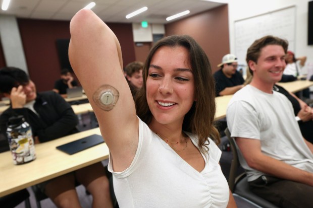 Continuous Glucose Monitors: Students Explore Their Health Impact