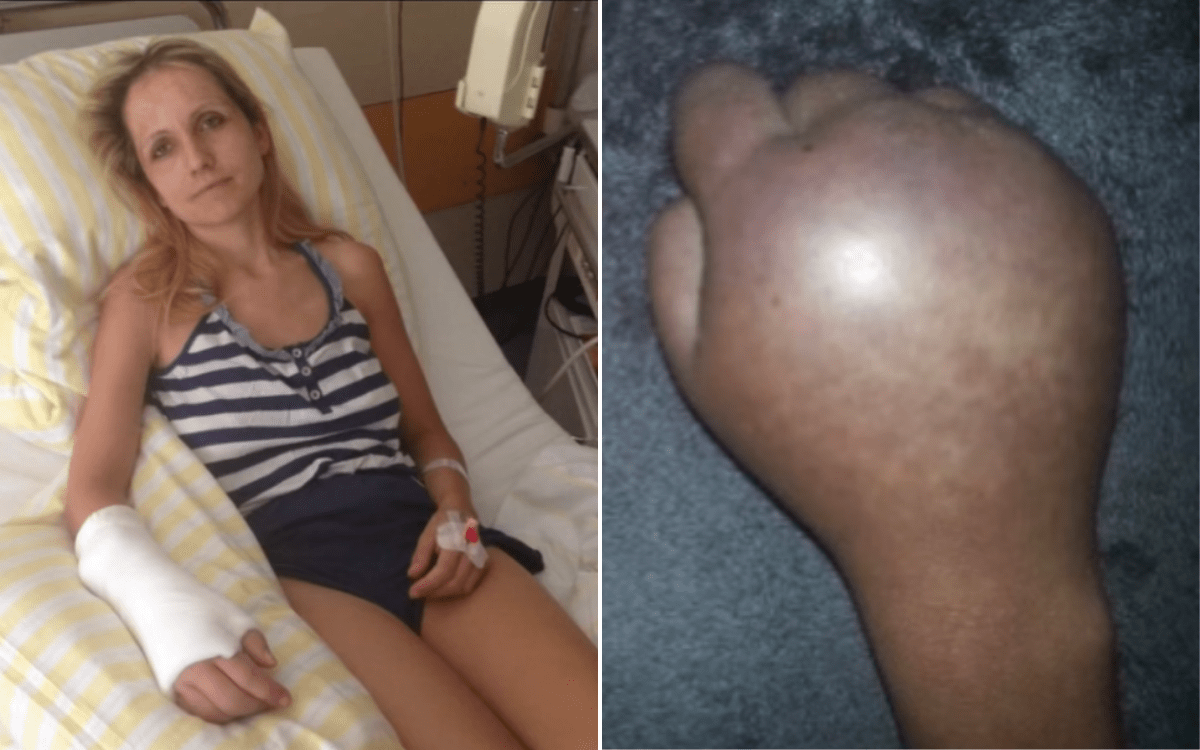 Woman’s Decade-Long Battle with CRPS