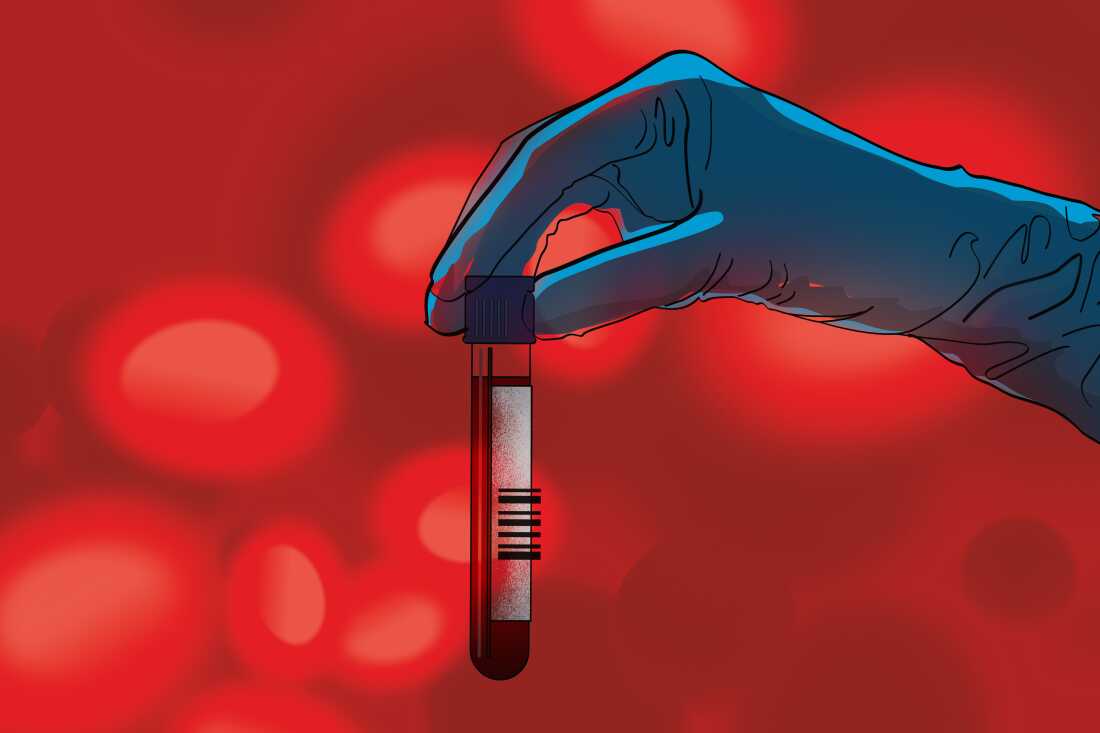 New Blood Tests: A Paradigm Shift in Cancer Detection