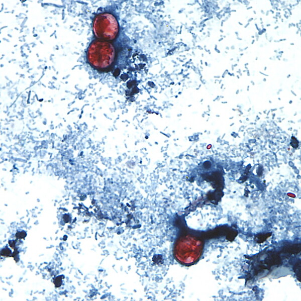 FDA Focuses on Taylor Farms’ Lettuce Amid Cyclospora Outbreak Despite Testing Error