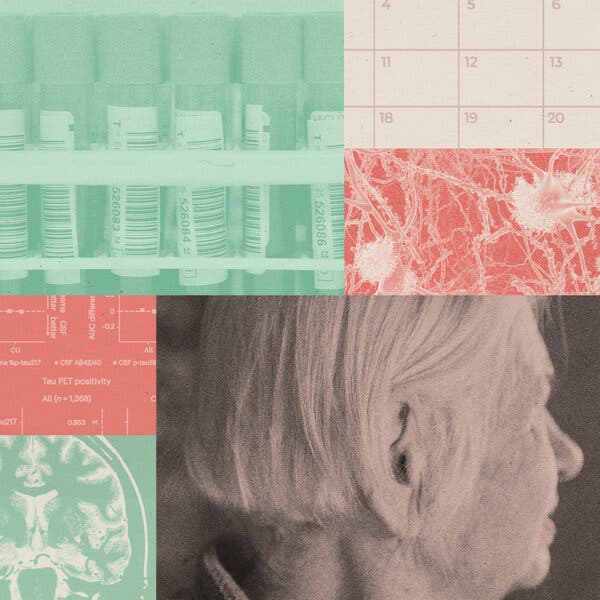 Blood Tests Show Promise for Alzheimer’s Diagnosis and Prediction