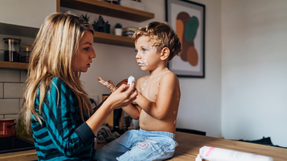 Measles Reemerges as Public Health Challenge in the U.S.