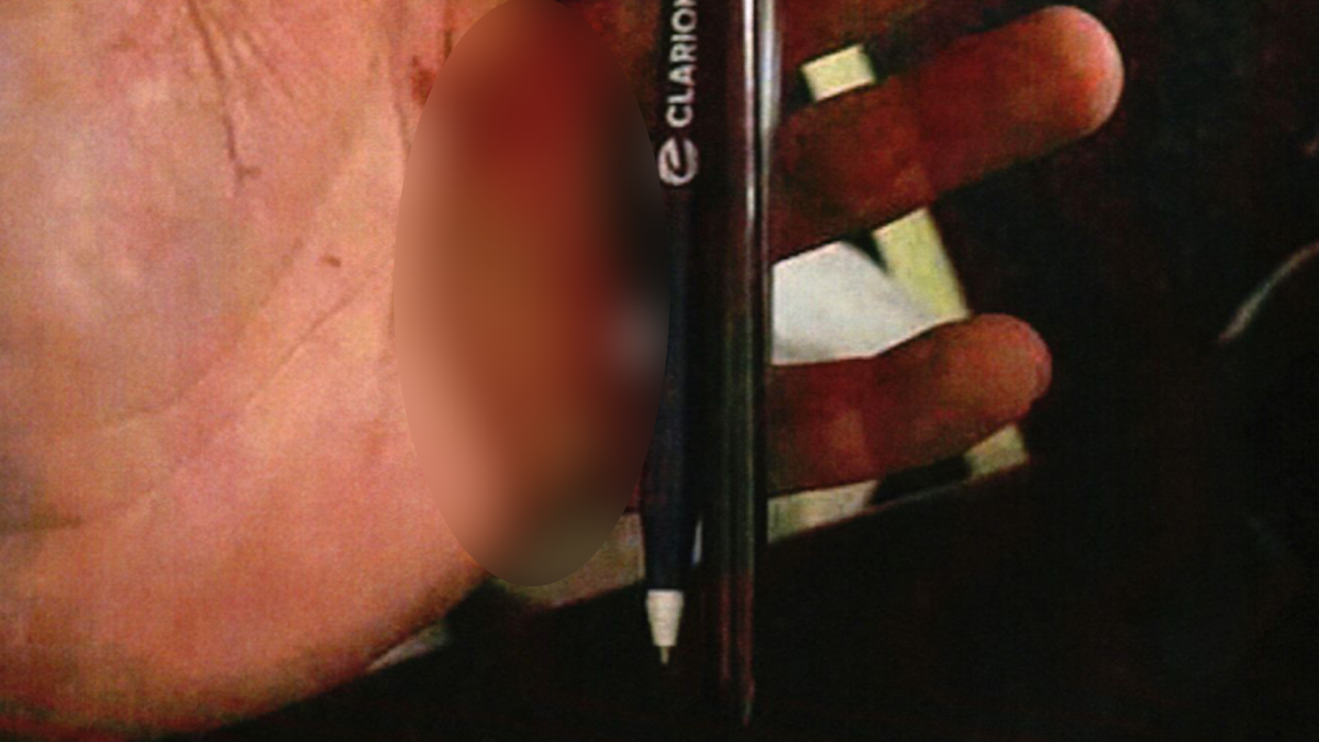 Airline Passenger Guilty of Assault with Pen Weapon