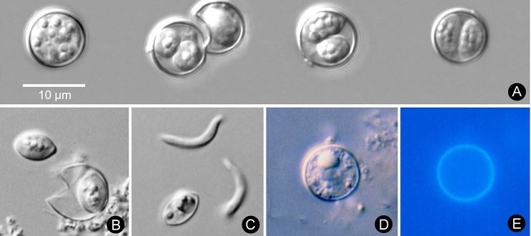 Michigan Cyclosporiasis Outbreak Potentially Linked to Lettuce