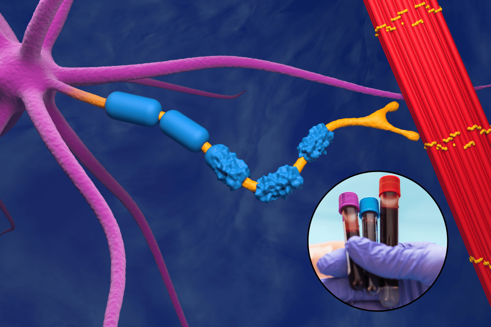 Blood Proteins Offer New Hope in ALS Pre-symptom Detection