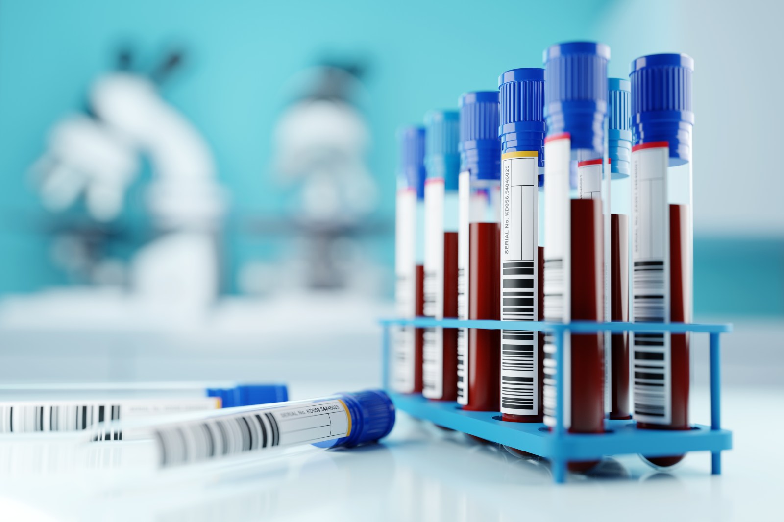 Blood Sample Analysis Offers Insight into Colorectal Cancer Progression