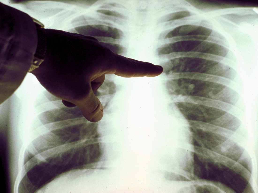 The Long and Evolving Journey of Cancer Treatment