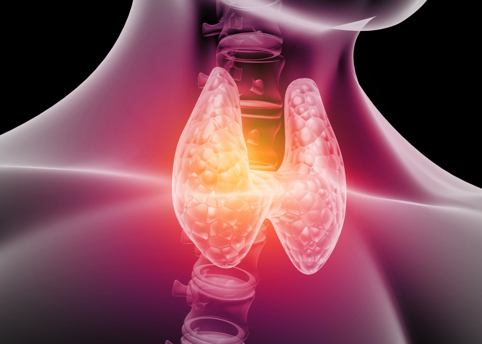 Routine Checkup Reveals Hidden Danger: A Rare Thyroid Cancer Diagnosed