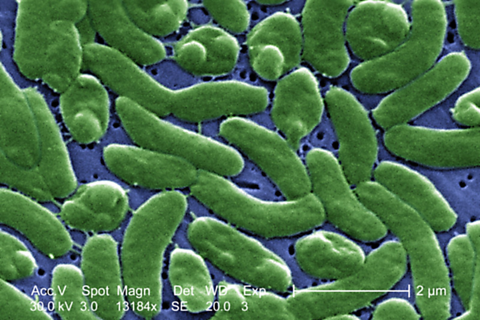 Potential El Niño Impact on Vibrio Vulnificus Cases