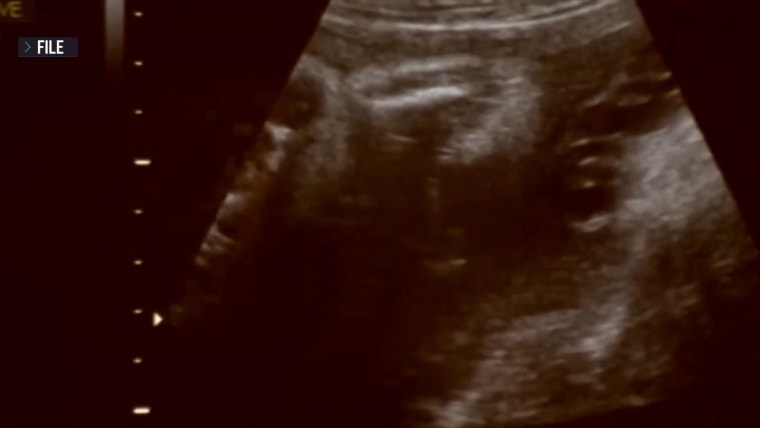 Legal Battle Surrounds Baby with Heart Condition
