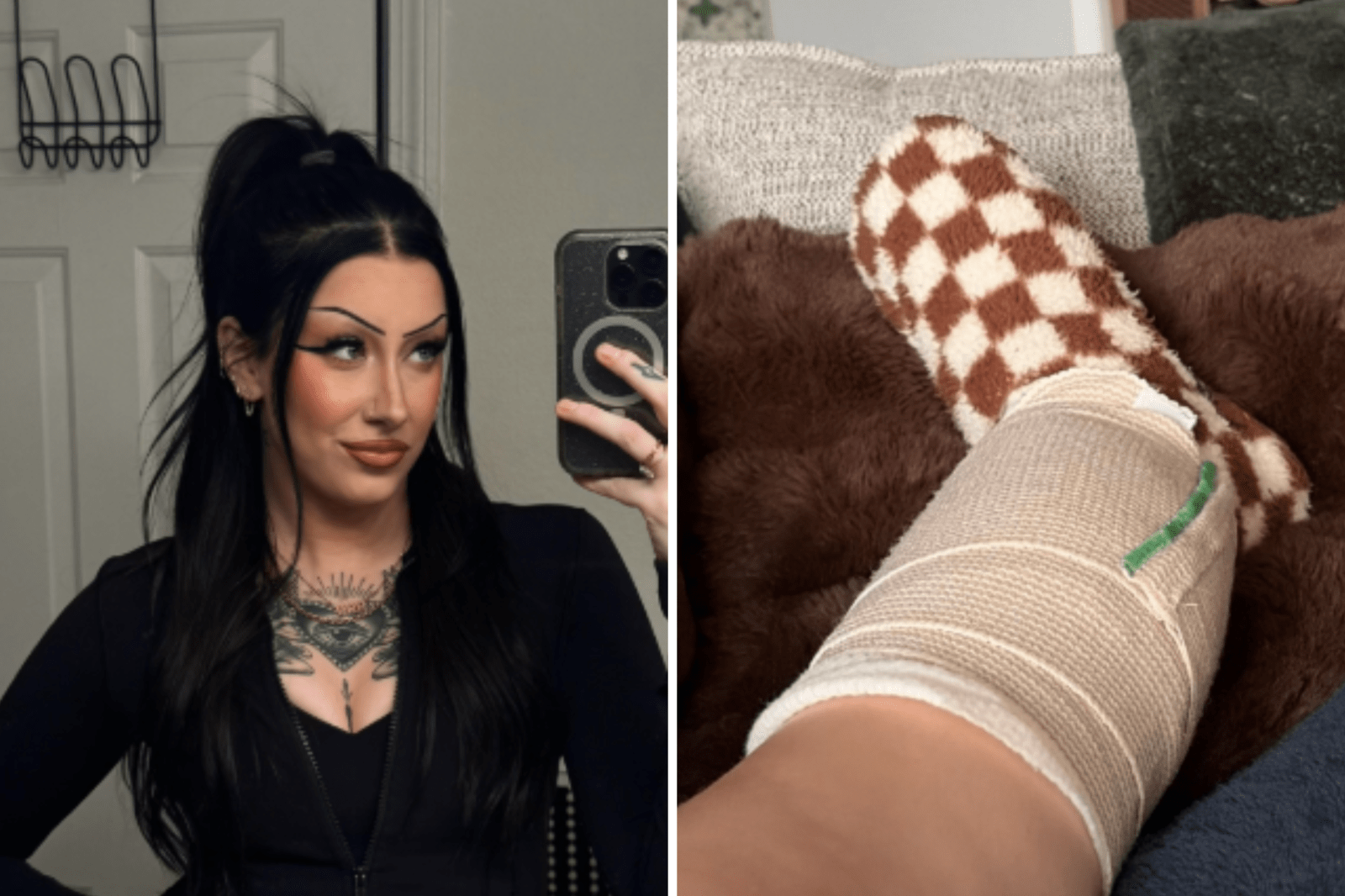 Young Woman’s Skin Cancer Story Highlights Importance of Routine Checks