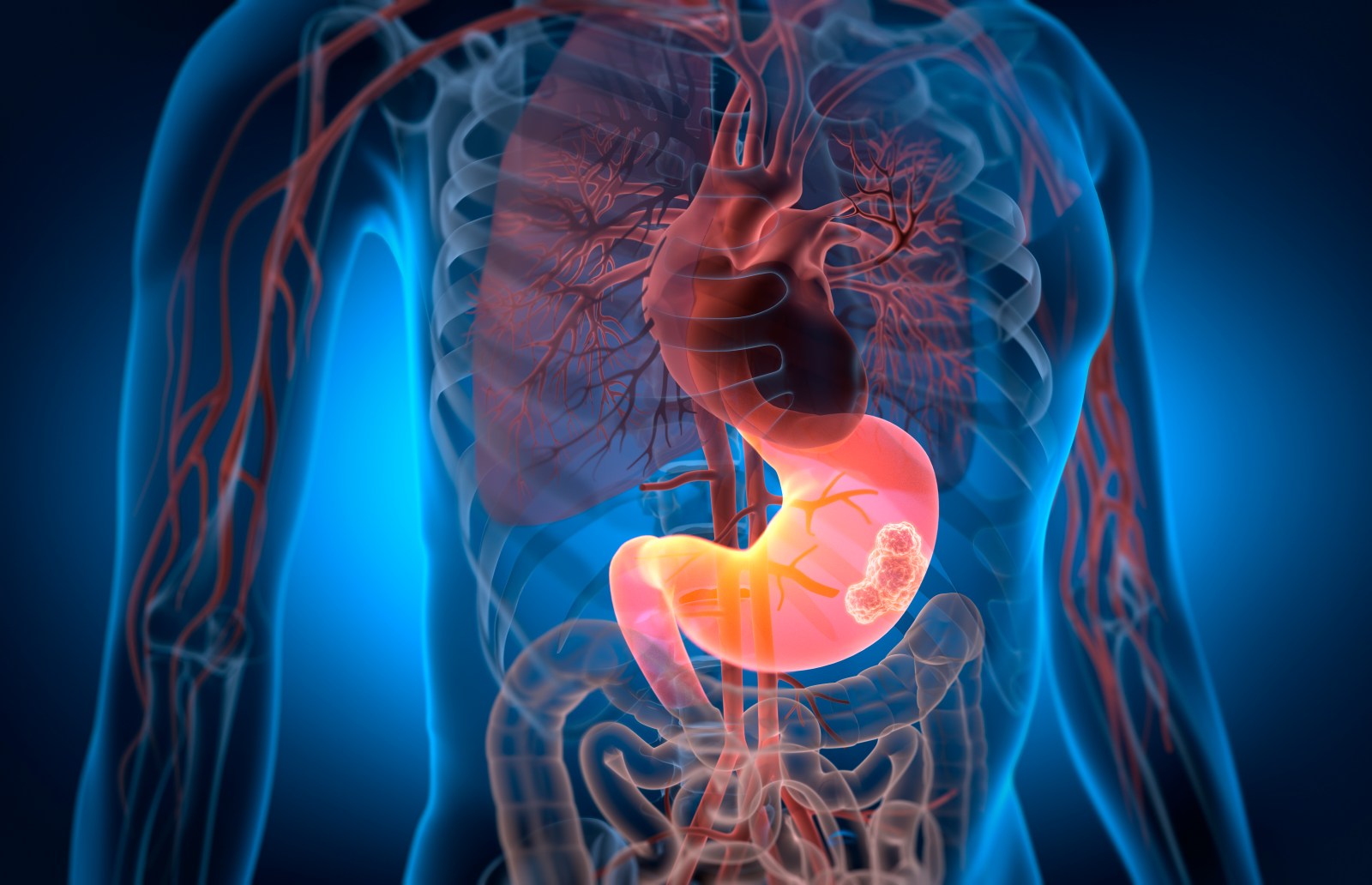 New Technique Offers Hope for Treating Solid Tumors