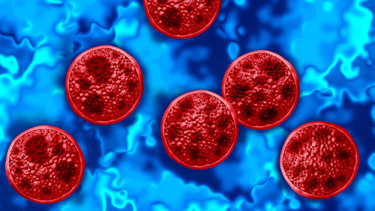 Cyclosporiasis Outbreak Affects 41 States