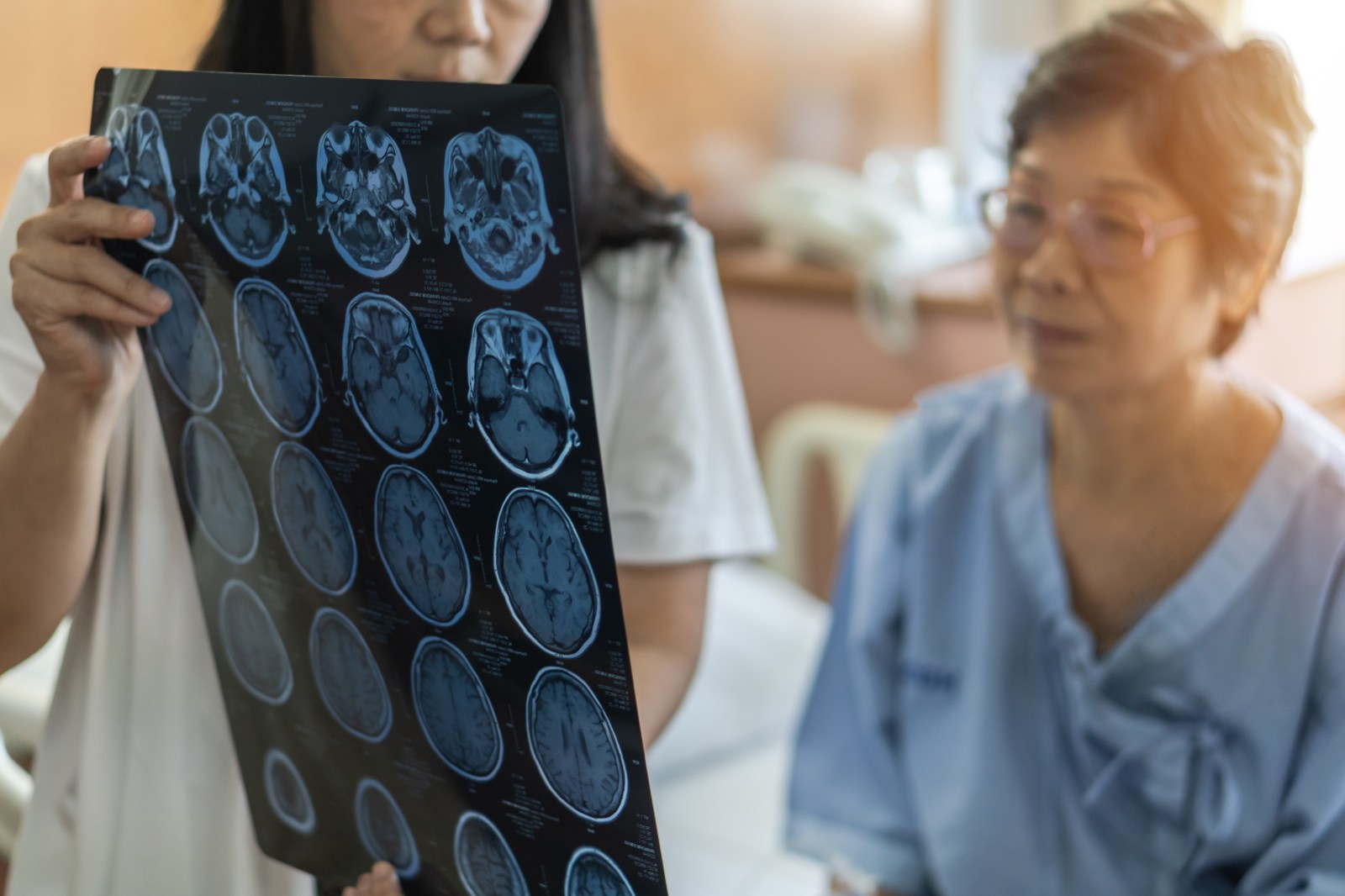 Dementia Risk Persists Beyond Age 90 According to New Study