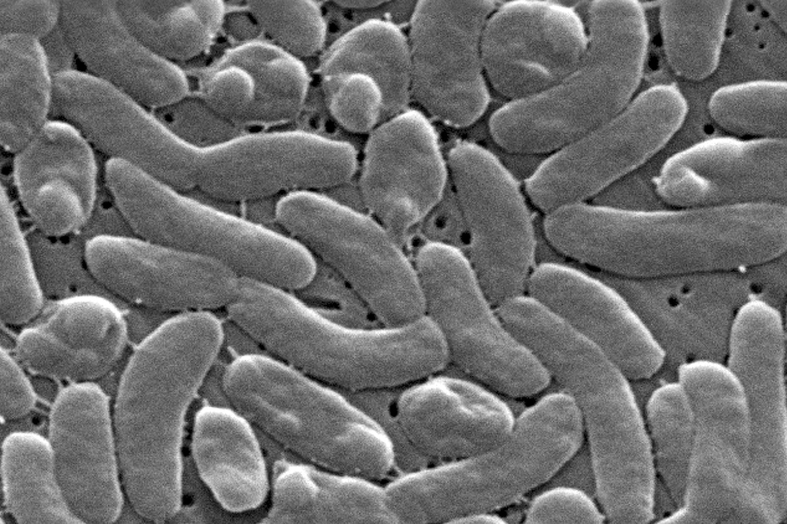 Rising Cases of Flesh-Eating Bacterium in Louisiana and Florida