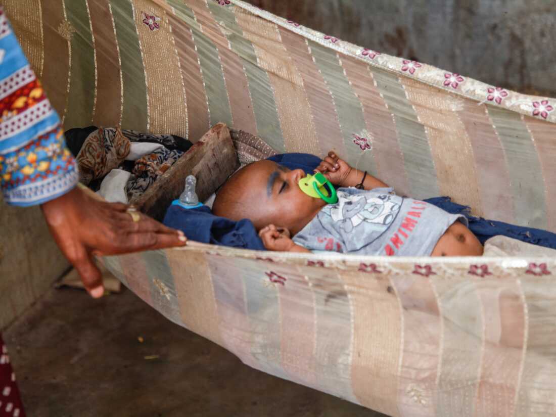 Challenges and Solutions in Addressing Premature Births in Rehri Goth, Pakistan