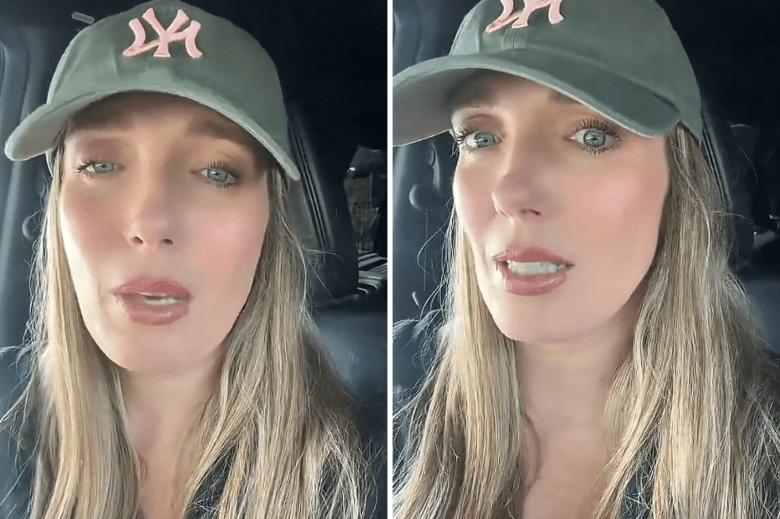 Woman’s Harrowing Experience Highlights Botox Risks