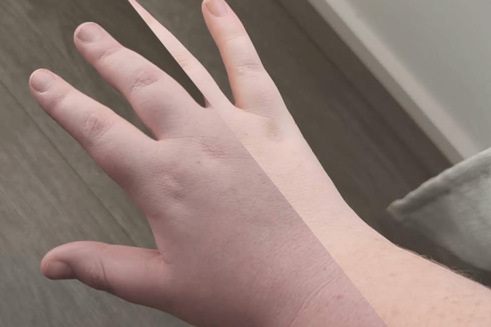 Raising Awareness for Rare Thoracic Outlet Syndrome: Elizabeth Lynch’s Journey