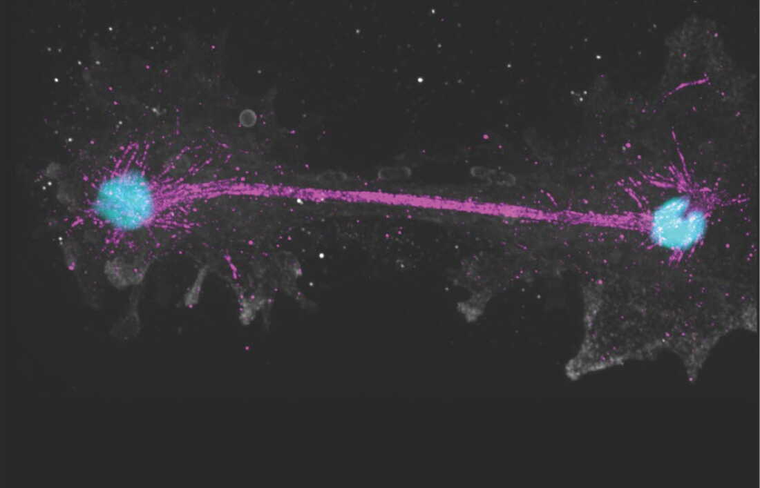 Introducing the Incendiamoeba Cascadensis: The Fire Amoeba