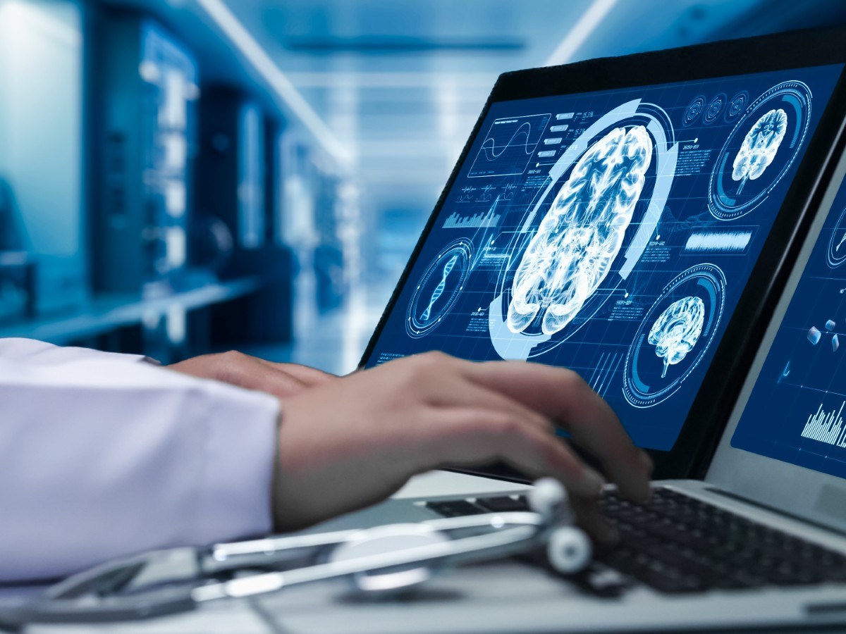Exploring Diets and Their Impact on Alzheimer’s Risk