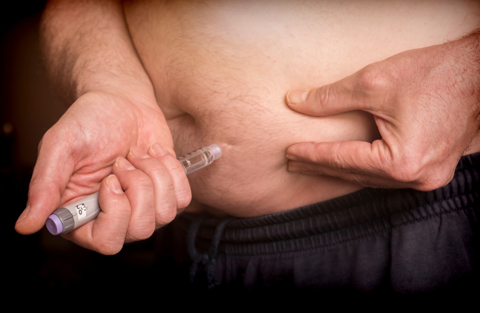 Study Links GLP-1 Weight-Loss Drugs to Increased Hair Loss Risk