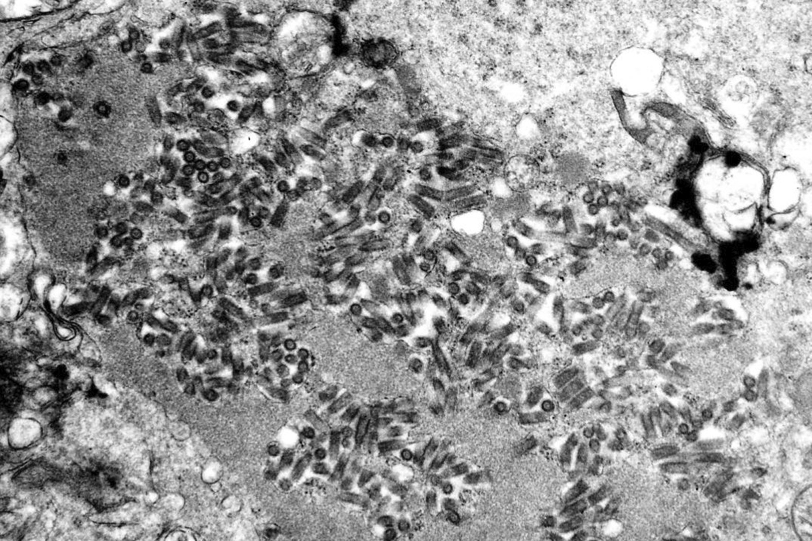 U.S. States Respond to Rabies Outbreak With Public Warnings