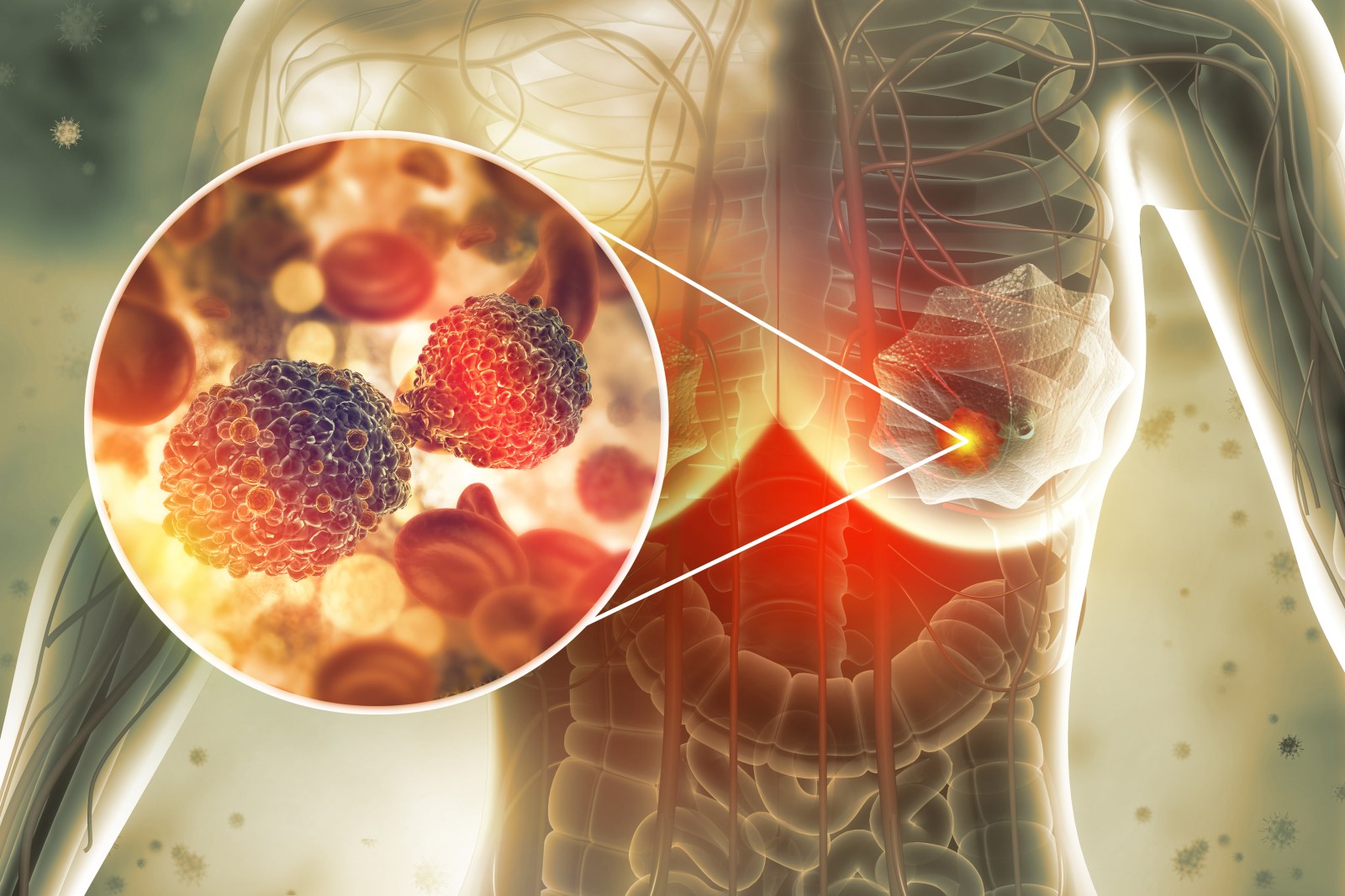 Mechanism Linking Dense Breast Tissue to Cancer Uncovered