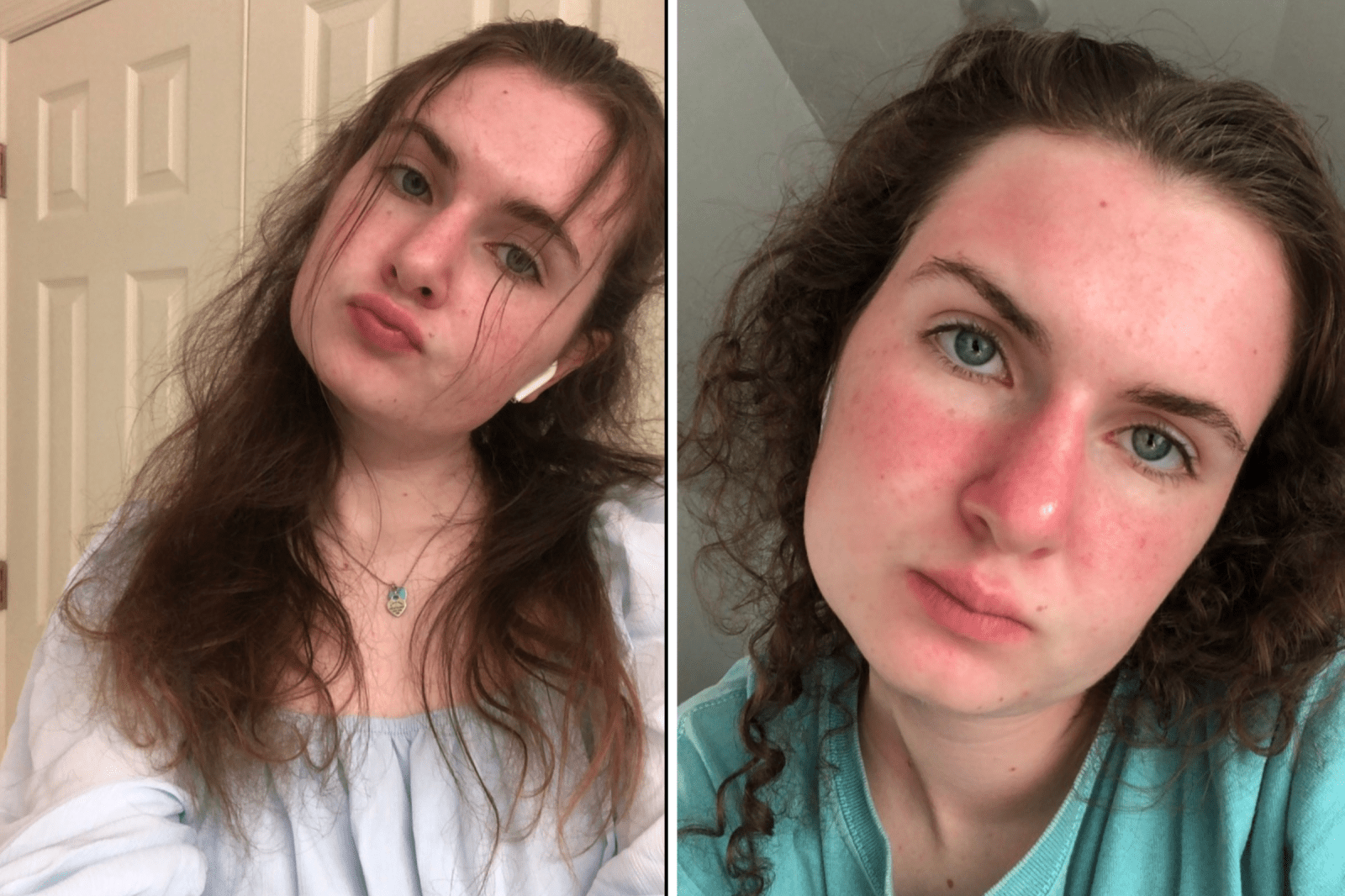 Navigating Life with Cushing’s Syndrome and Cancer