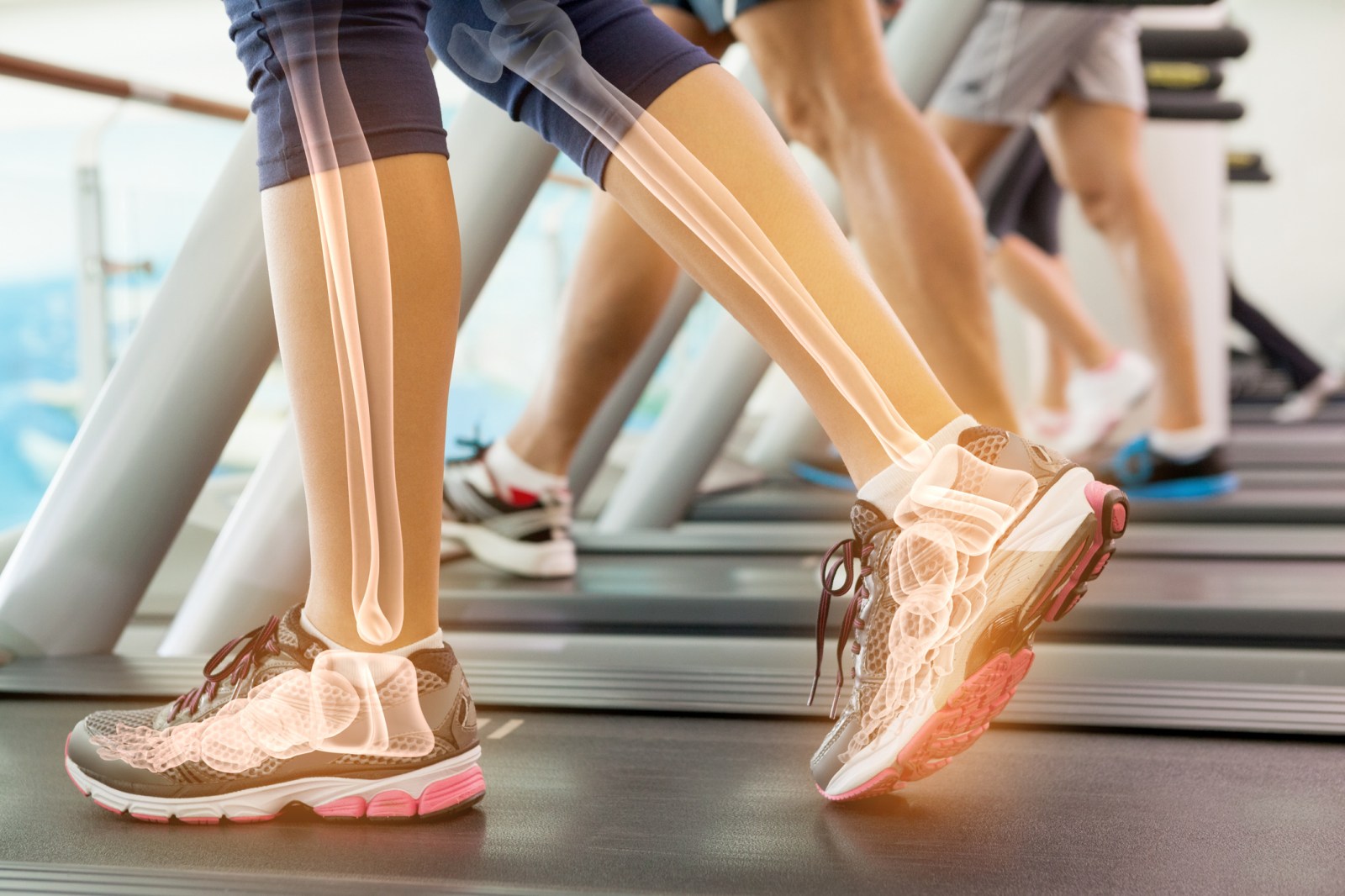 Understanding Bone Health: Habits and Strategies to Maintain Strong Bones