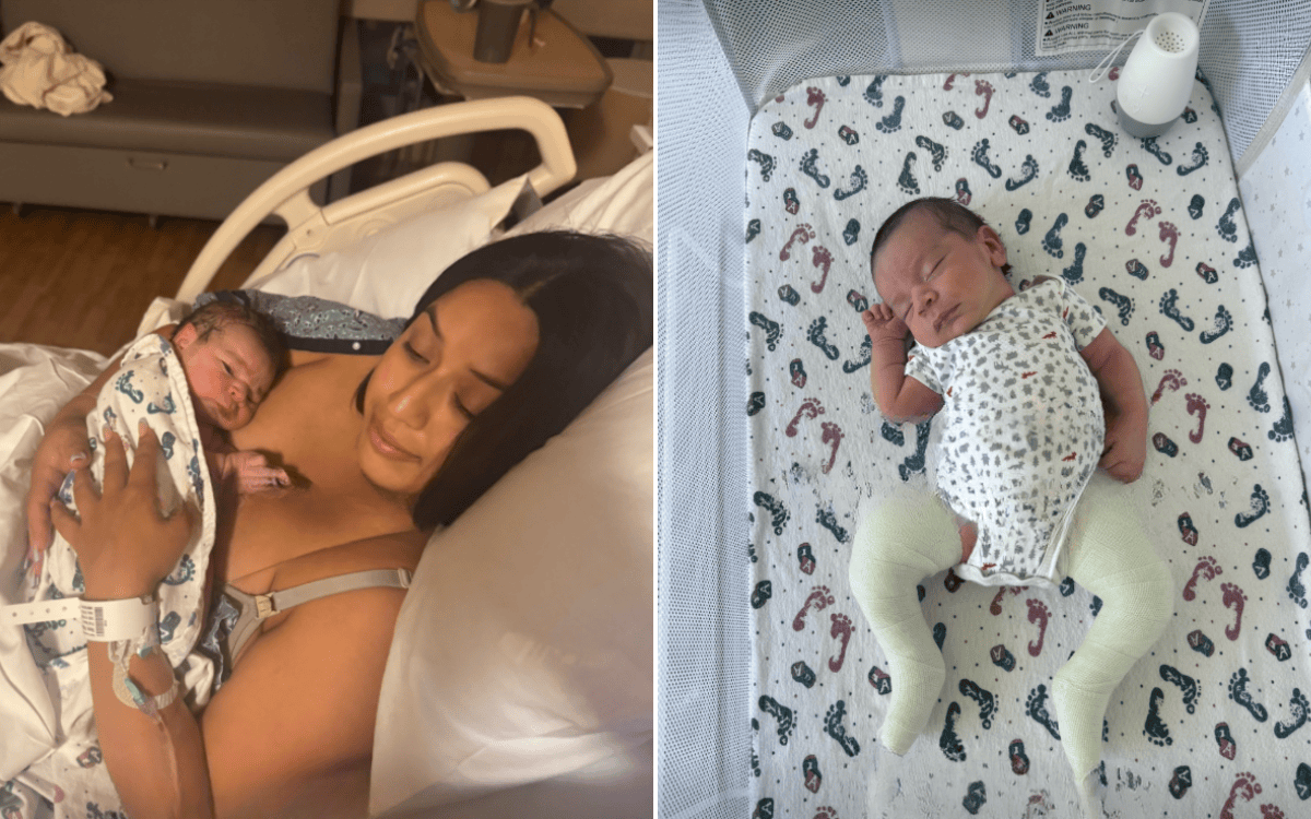 Michelle Reyes Shares Her Son’s Journey with Clubfoot