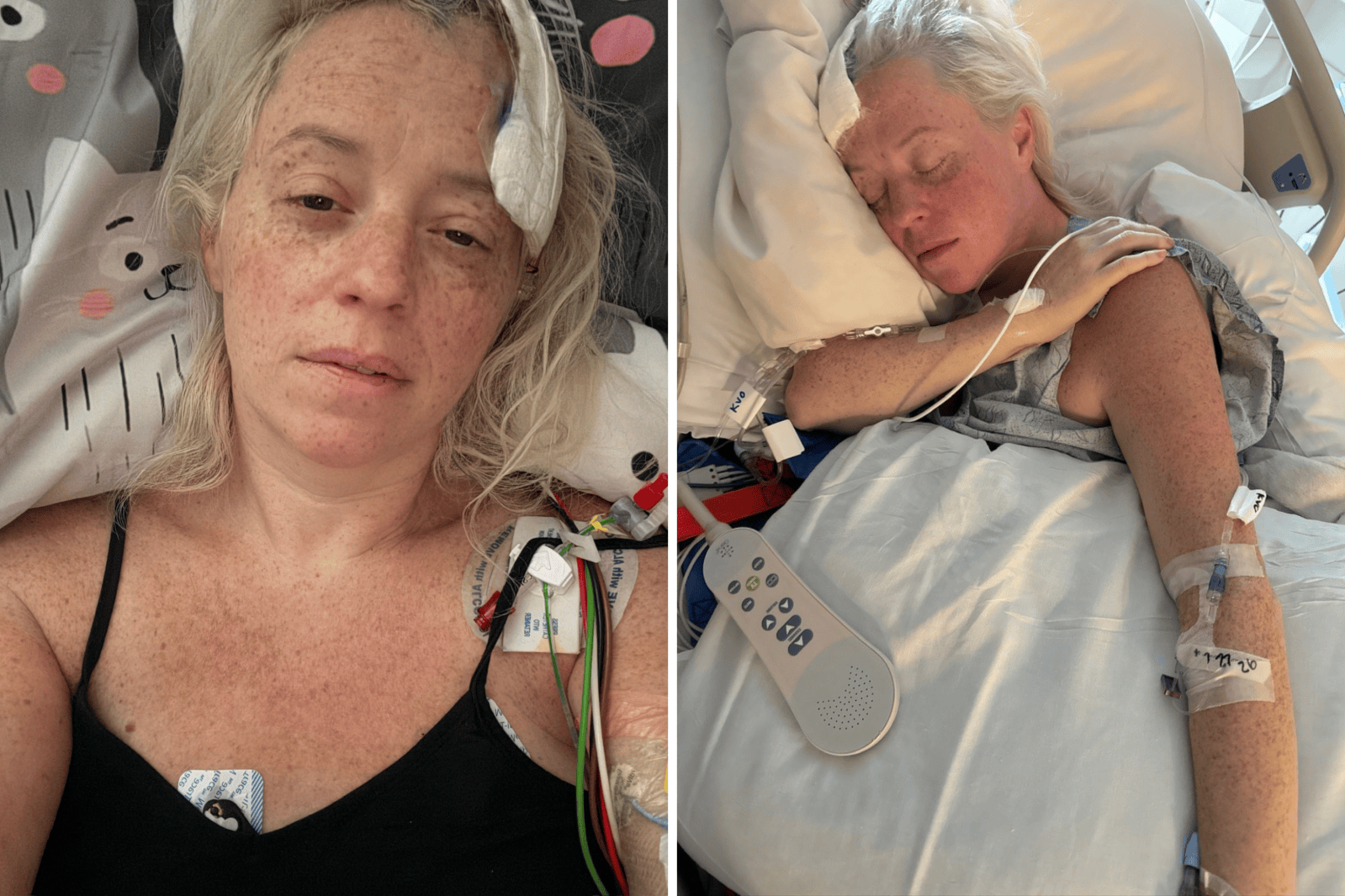 Surviving a Ruptured Brain Aneurysm: Julie Nashawaty’s Journey