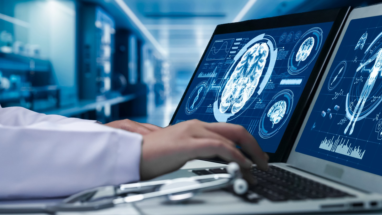 Link Between Epilepsy and Young-Onset Dementia Explored