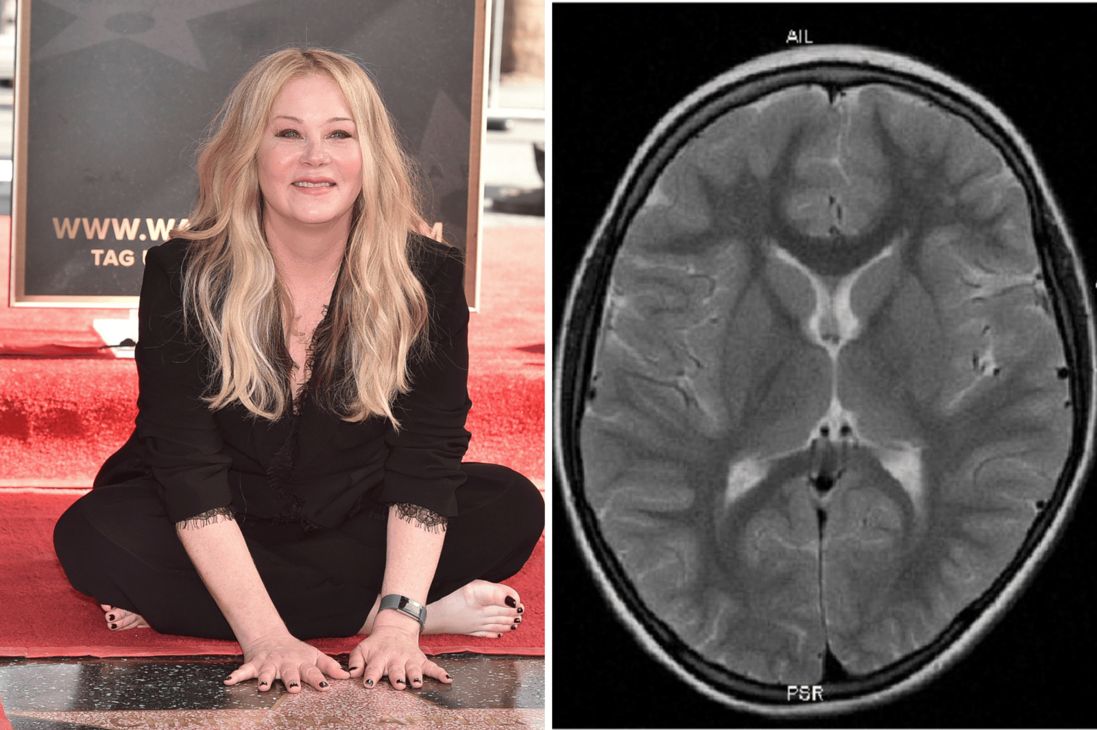 Christina Applegate Shares Misdiagnosis Experience and Ongoing Health Challenges