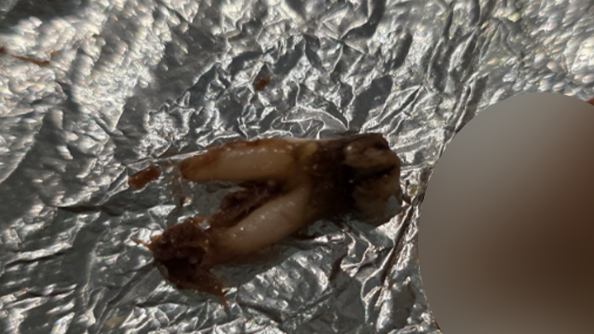 Cow Tooth Allegedly Found in Taco Leads to Lawsuit Against Torchy’s Tacos