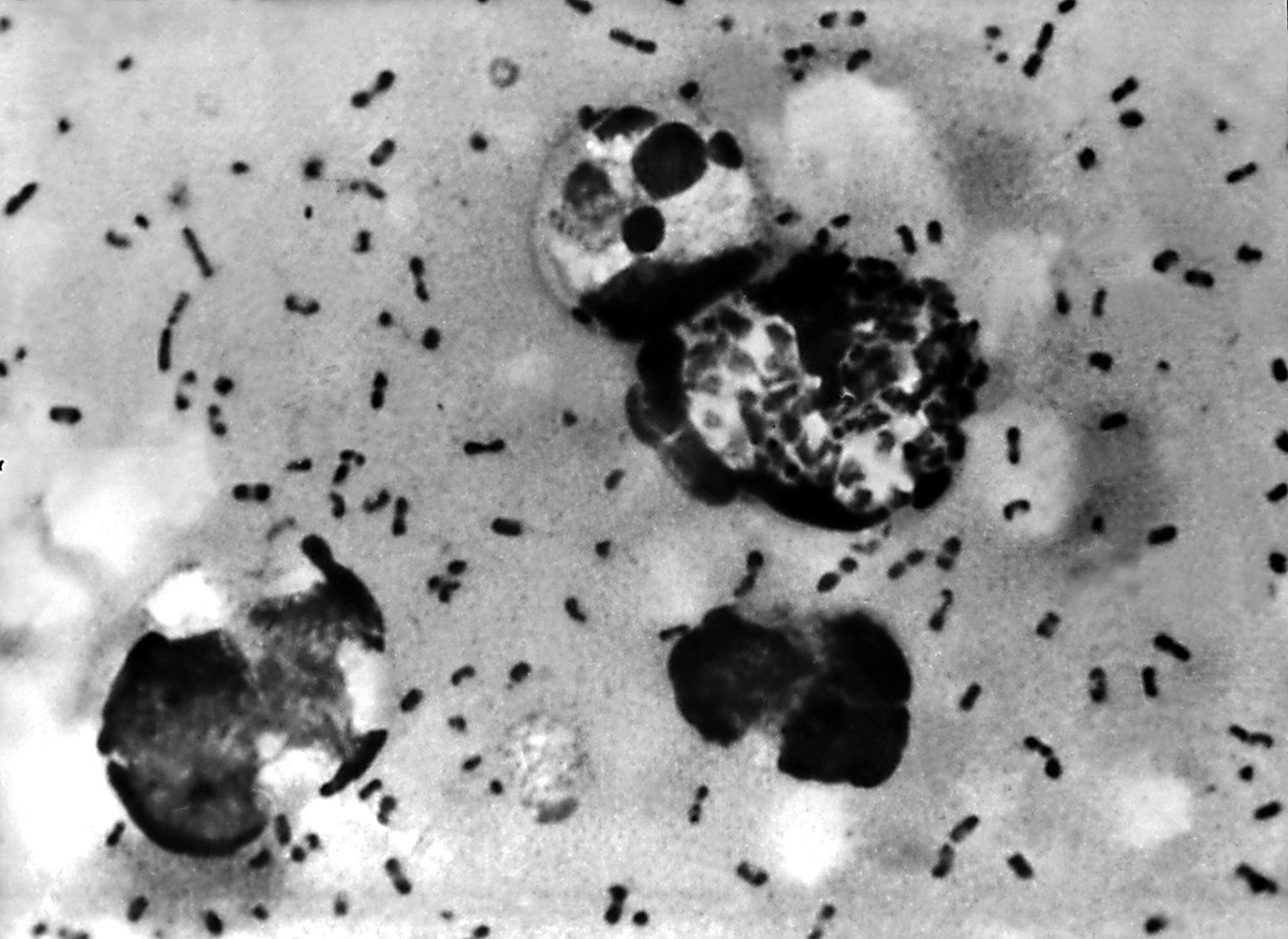 Plague Outbreak in Siberia: Anti-Epidemic Action Initiated
